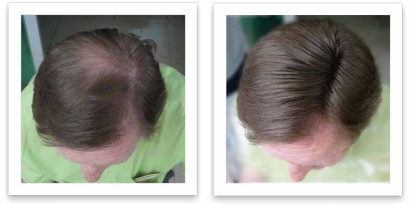 Caboki Hair Fiber Hair concealer in Karachi image 13