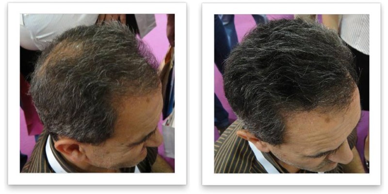 Caboki Hair Fiber Hair concealer in Karachi image 15