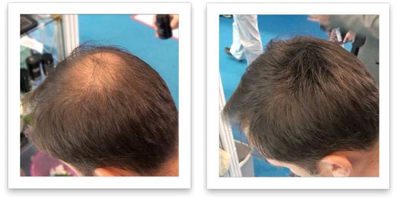 Caboki Hair Fiber Hair concealer in Karachi image 16