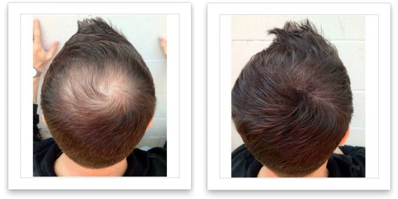 Caboki Hair Fiber Hair concealer in Karachi image 2