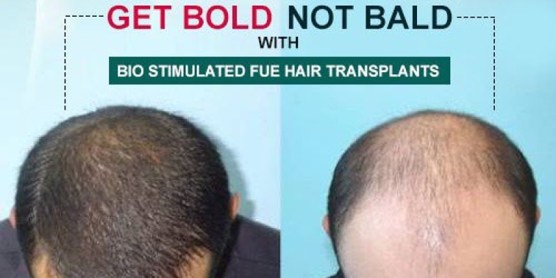 20% Discount at Defence Skin Clinic With Alied Bank 2 