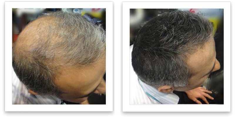 Caboki Hair Fiber Hair concealer in Karachi image 4