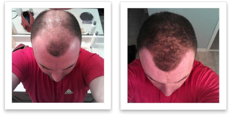 Caboki Hair Fiber Hair concealer in Karachi image 9